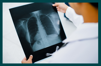 What can a chest X-ray diagnose? Everything you need to know
