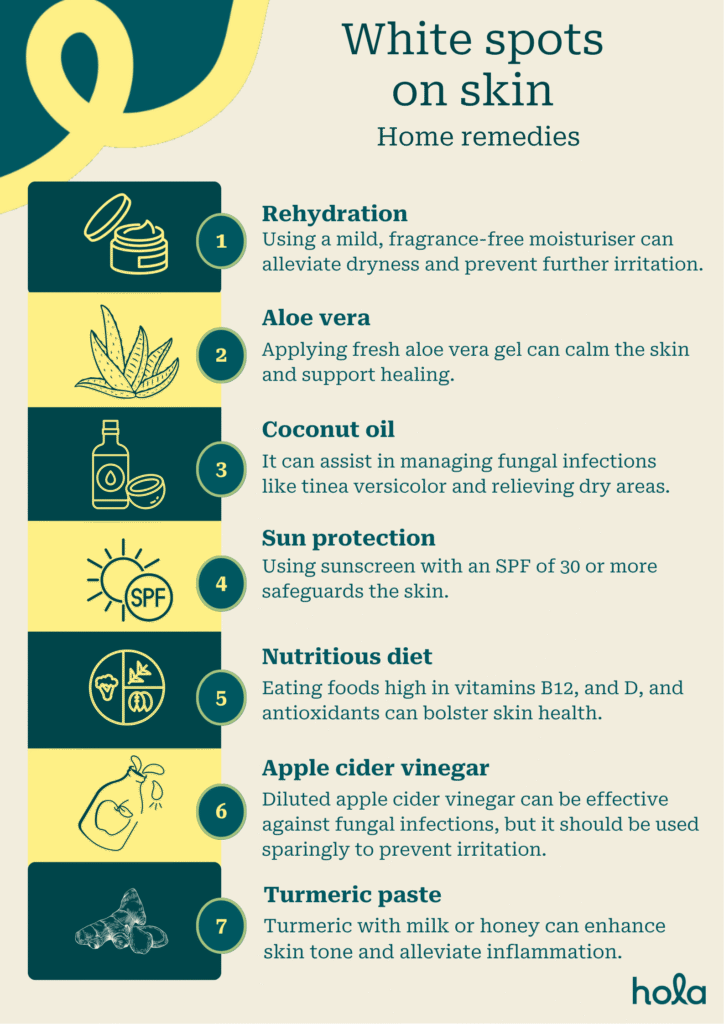 white spots on skin - home remedies