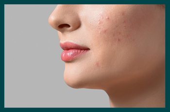 White spots on skin: Possible causes and next steps 